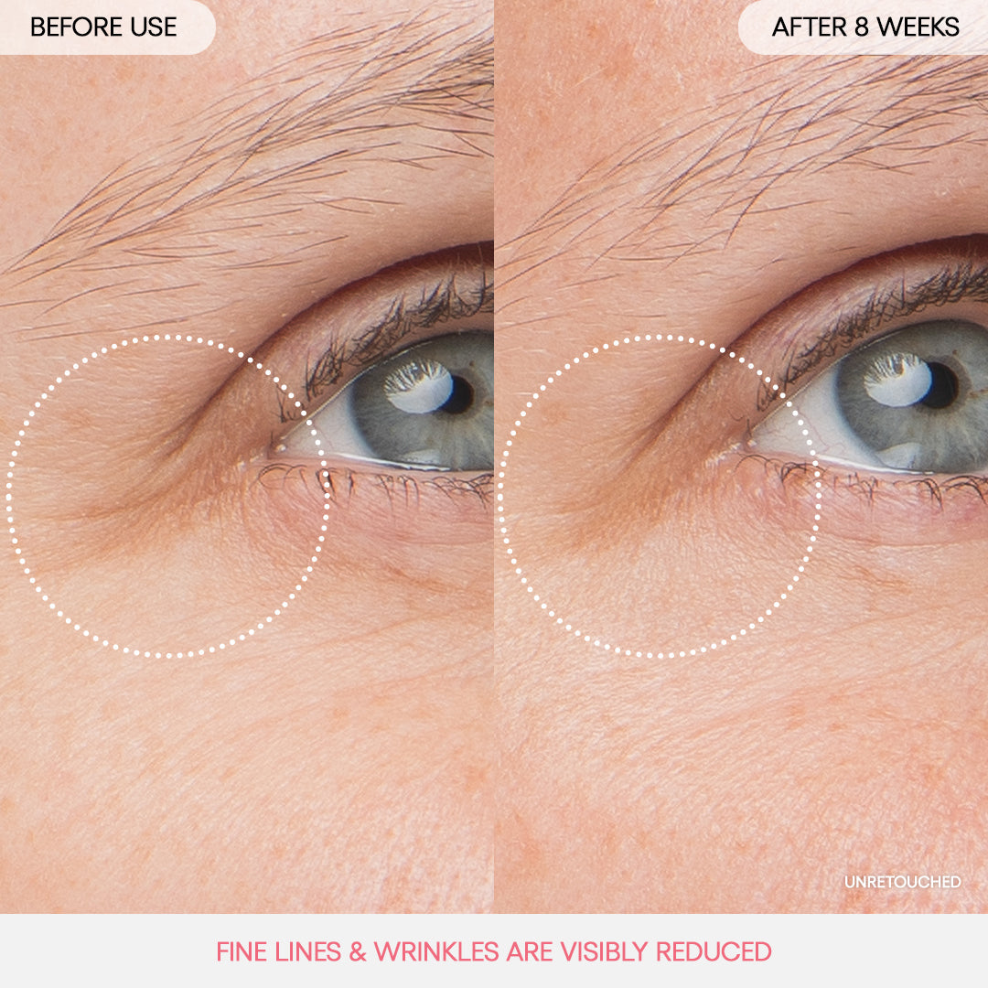 Bouncy & Firm Eye Sleeping Mask Skincare Choices for Everyday Plans