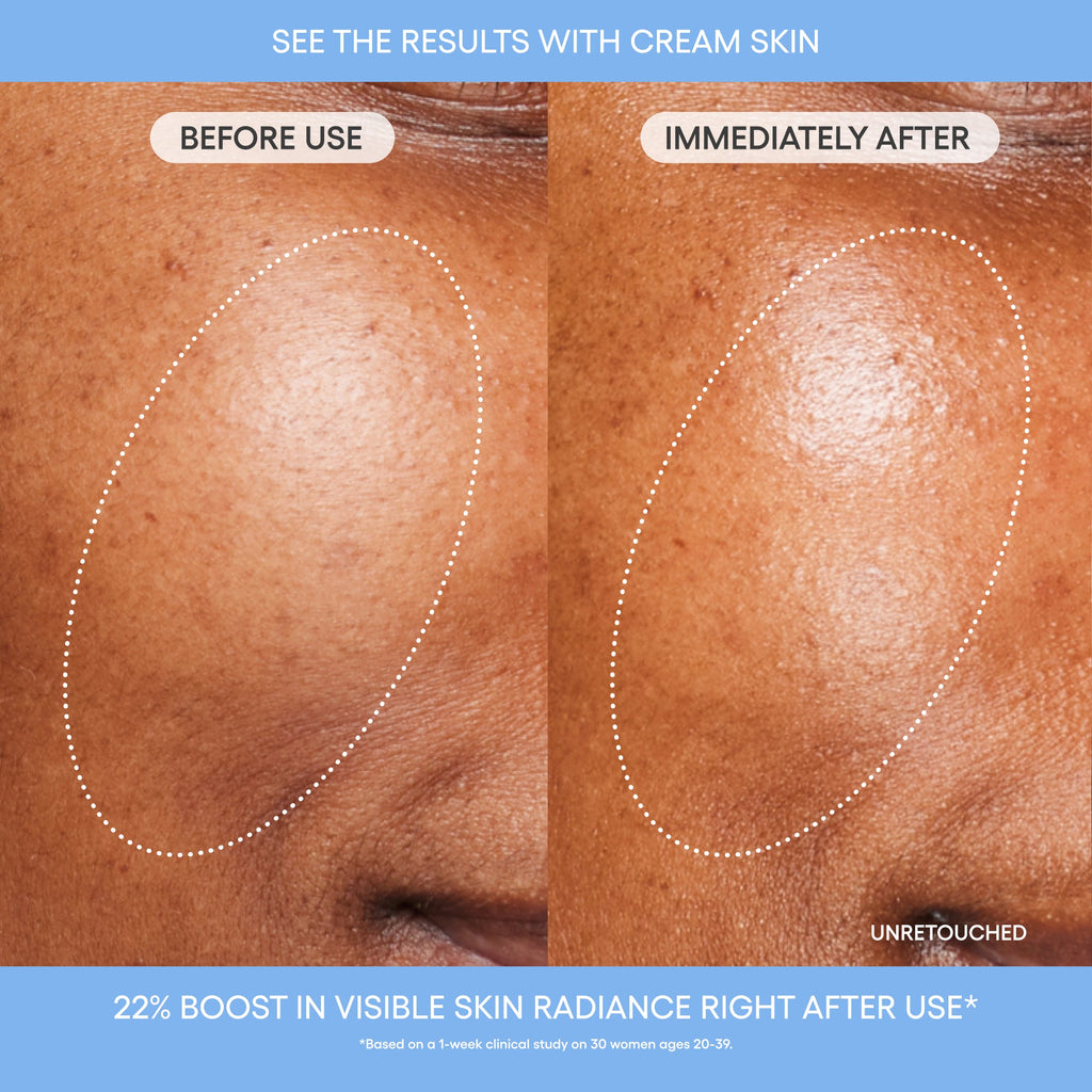Before and after comparison of skin cream use on model