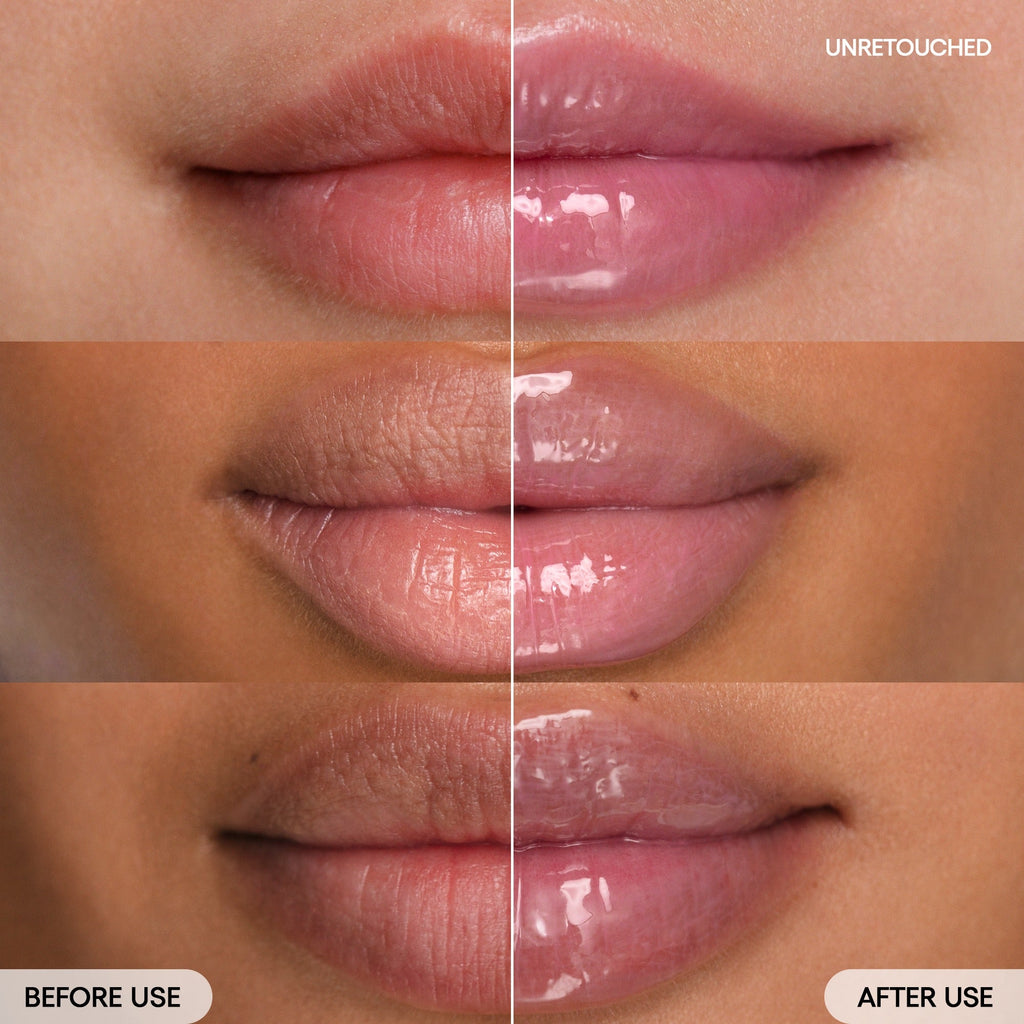 before & after Lip Sleeping Mask Gummy Bear on model.
