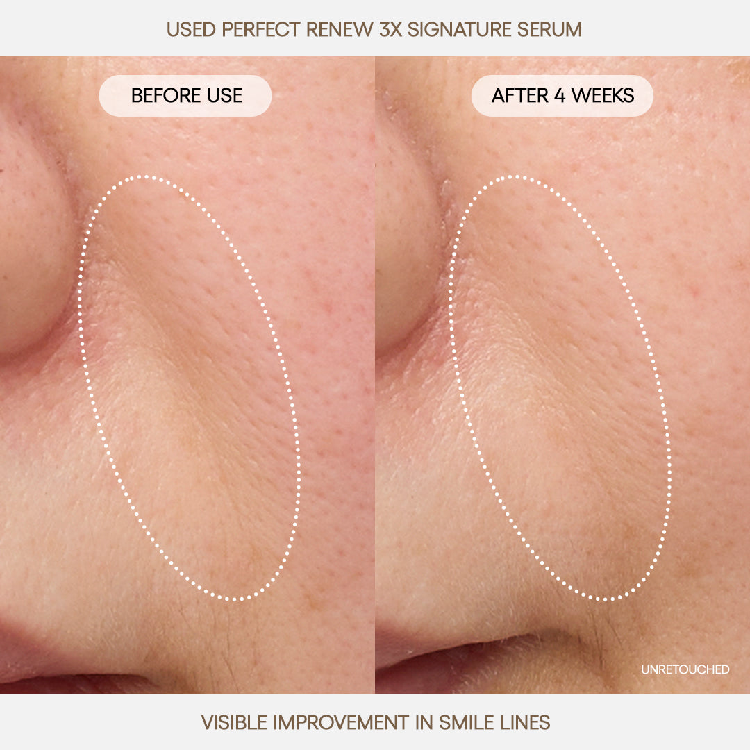 Perfect Renew 3X Signature Serum Your Daily Beauty Choice