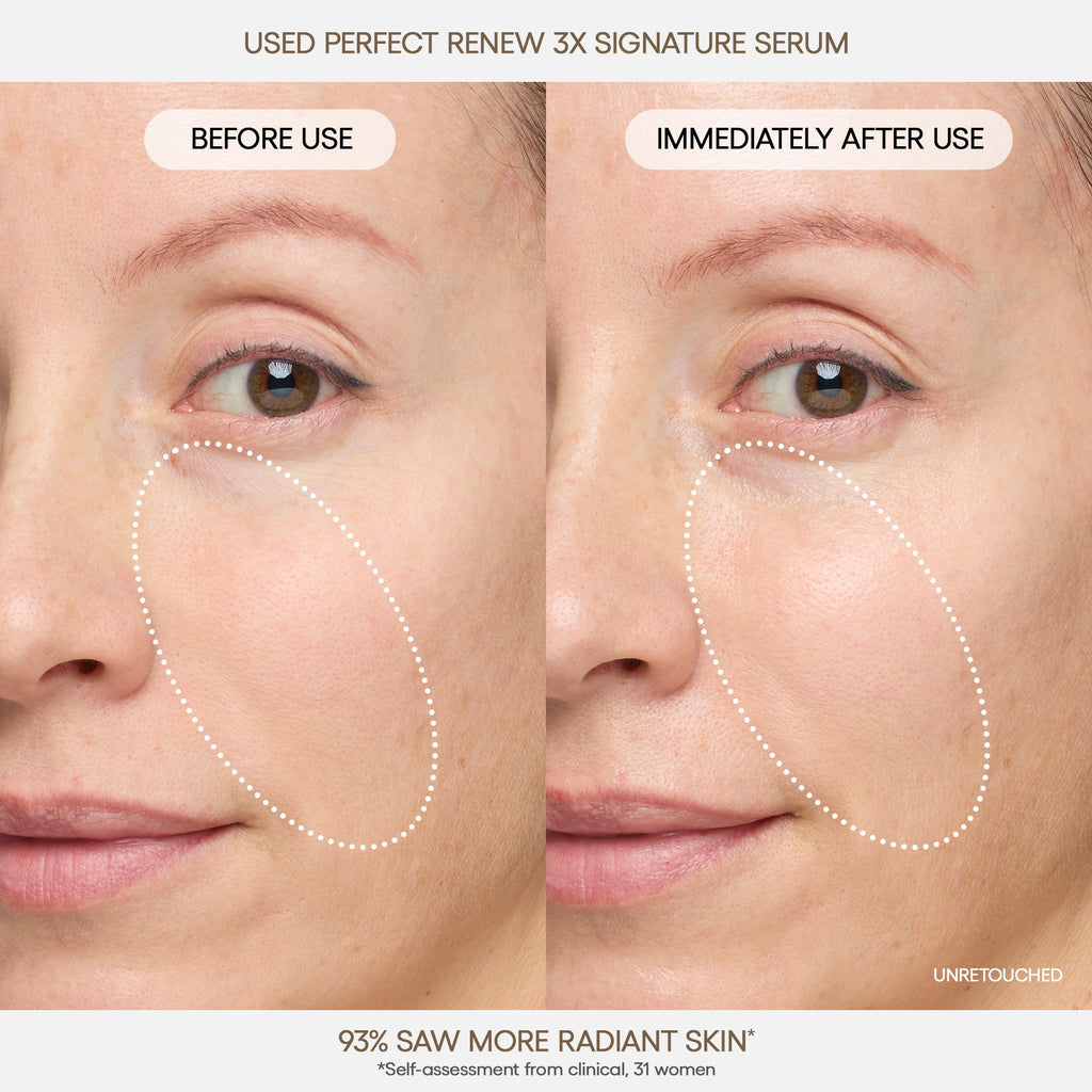 Perfect Renew 3X Signature Serum Your Daily Beauty Choice