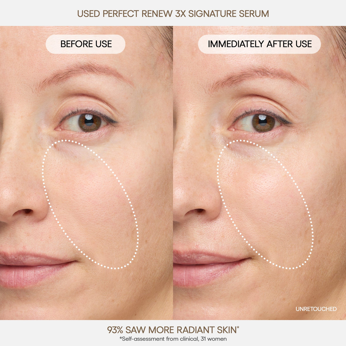 Perfect Renew 3X Signature Serum Your Daily Beauty Choice